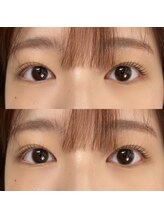 フィービー(pheebe)/ラッシュリフト