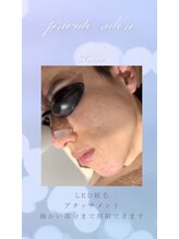 チル(chill)/脱毛にて細部まで照射出来ます