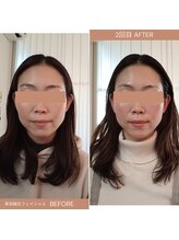 サルビア(SALVIA)/美容鍼灸フェイシャルエステ　１