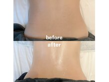 グレアージュ(GLEAGE)/全身痩身凹凸脂肪コース！