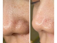 サイ(Sai)/before⇒after