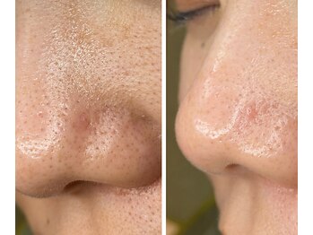 サイ(Sai)/before⇒after