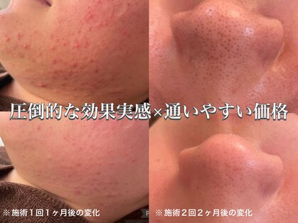 リラ(Lilas)の写真