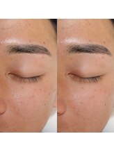 クロエ 京都河原町店('chloe')/メンズ眉毛ワックス