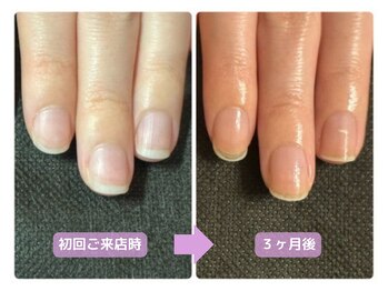 ネイルサロン ベルエトワール(belle etoile)