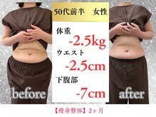 ボディメイク アールエフ サクラ接骨院(bodymake RF SAKURA接骨院)/50代　2ヶ月で下腹部ー7cm