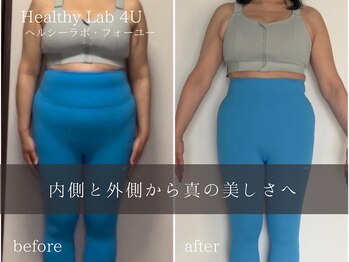 ヘルスラボフォーユー(Health Labo4U)/ダイエットプロフラム