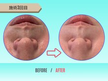 癒し工房ゆらぎ(YURAGI)/BEFORE/AFTER