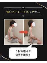 整体 寿 立川院(KOTOBUKI)/ひどいストレートネックが・・！