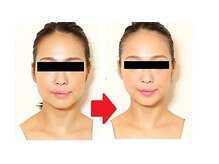 サンライズ整体院の雰囲気(小顔矯正+全身整体 全身が整い不調も改善!小顔+姿勢美人に!)