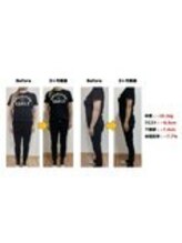 ヘルスケアエイド鍼灸接骨院 蘇我院/３ヶ月集中ダイエットコース