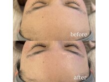 アリー(Aliiy)/フェイシャルWAX