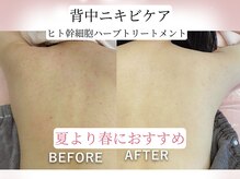 ビカオ(BIKAO)の雰囲気（リアボーテ/タラソハーブ/商品のみの購入もOK/小顔/毛穴）