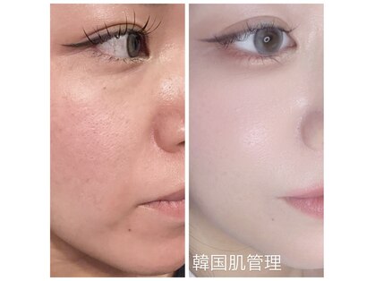 ラヴィ(Raviy)の写真