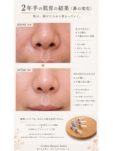 クレビア(Crebia)/肌質改善毛穴レス