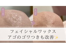 ジョリー(JOLIE)の雰囲気(産毛が邪魔してベタついてないですか?)