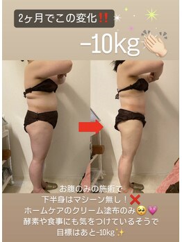 サロン ドゥ レーベル(Salon de Label)/1ヶ月集中通い放題！