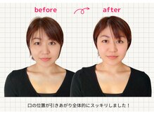 ナチュラルハリー(NaturalHarry)/当サロン自慢の経絡小顔施術！