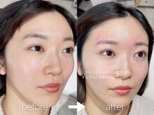 ジョリー(JOLi)/眉毛ワックス×まつげパーマ