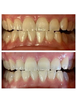 ホワイトプラン/5回目の変化☆