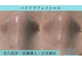 リメイク 広尾(REMAKE)/