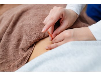 マーサ鍼灸接骨院 栗田院/鍼灸/腰痛改善/肩こり