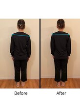 氣生/1回の施術で効果を実感/姿勢改善