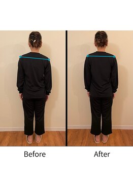 氣生/1回の施術で効果を実感/姿勢改善