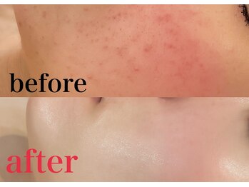 ライズビューティーサロン(Rise Beauty Salon)/☆ビフォーアフター☆