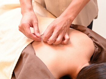 すばる屋の写真/お悩みの根本に働きかける鍼灸。痛みが少なく心地の良い鍼と灸で巡りよく軽やかな日常に♪美容鍼も当店人気