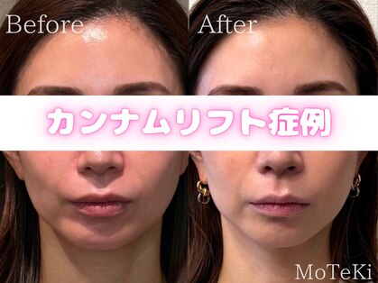 モテキ 表参道店(MoTeKi)の写真
