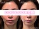 モテキ 表参道店(MoTeKi)の写真