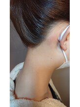 キアラ 麻布十番(Kiara)/うなじ脱毛ワックス脱毛後