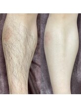 ウルル(ULuLu)/メンズやりたい部門2位