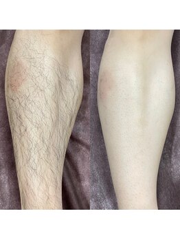 ウルル(ULuLu)/メンズやりたい部門2位