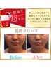 【最強小顔】筋膜リリースで歪みも脂肪もたるみも改善！エイジングケアにも◎