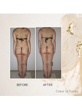 クーラ テュセ(Coeur la Tusais)/【40歳まで】全身まるごと痩身