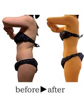 スタイルアップボディ ナゴミ(スタイルアップBODY！NAGOMI)/挙式を控える花嫁様を応援/緑区