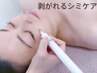 【話題のシミケア機器が菊池に】シミ集中デトックスケアお試し¥5000