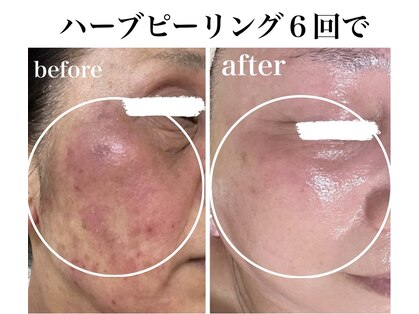 ラ ヴォーテ(La beaute)の写真