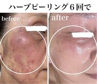 ラ ヴォーテ(La beaute)