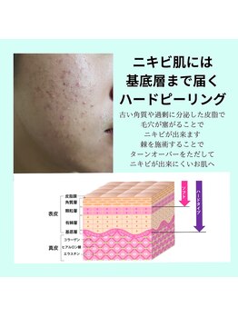 レヴェランジュ(Rebellange)/