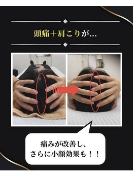 整体 寿 立川院(KOTOBUKI)/頭痛＋肩こり＋小顔効果！