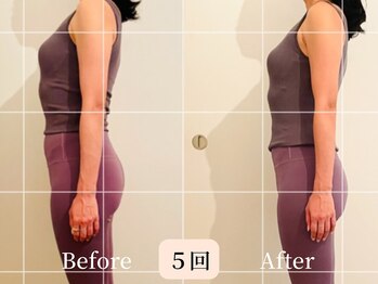 ロシュニ/40代 お悩み:たるみ/肋骨の厚み