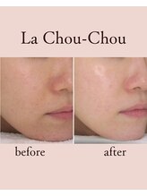 ラシュシュ(La Chou Chou)/◇水光肌◇ツヤ、毛穴レス