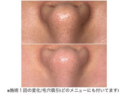 ハピスリー(Hapisley)の写真