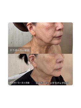 ルビーサロン(ruby-salon)/