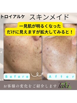 リラクゼーションサロン ラキ(laki)/お肌をきれいにしたいなら
