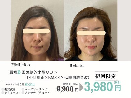 エスポワール(espoir)の写真