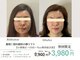エスポワール(espoir)の写真